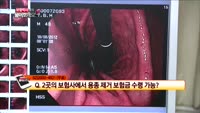 [보험박사에게 물어보세요] 수술특약 가입자 1종 보험급 수령가능