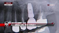 [집중관찰] 오스템임플란트 (7) 투자분석 - 차대웅 MBN골드 전문가