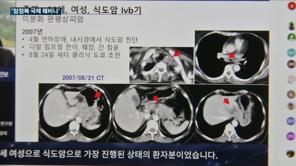 최신 암 치료법 정보가 한곳에…'암정복 국제 웨비나' 개최