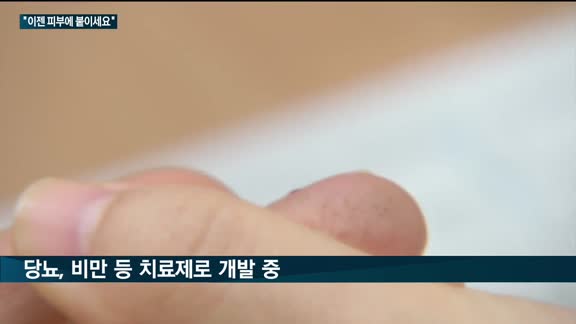 "이젠 피부에 양보하세요"…제약업계, 붙이는 치료제 '마이크로니들' 개발