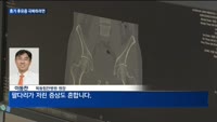 온몸 뻐근한 '휴가 후유증' 예방하려면…"몸 자주 움직여줘야"